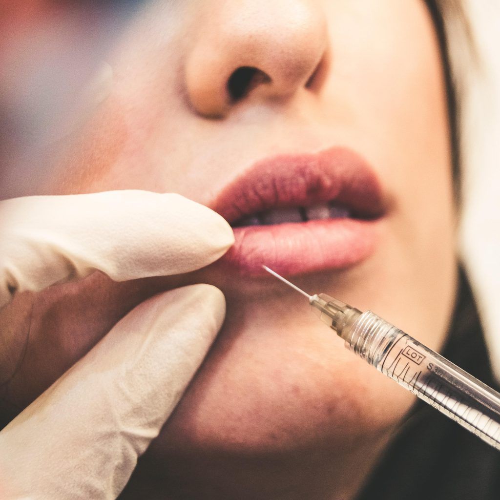 The Kylie Jenner Effect: Doctors Share Lip Filler Dos and Don’ts