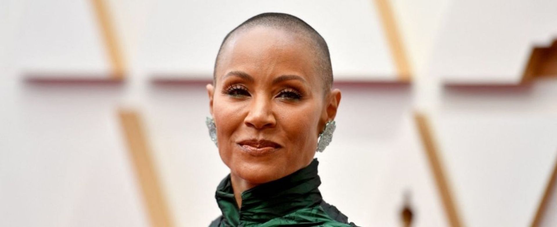 Celebrities speak of the pain of hair loss and going bald