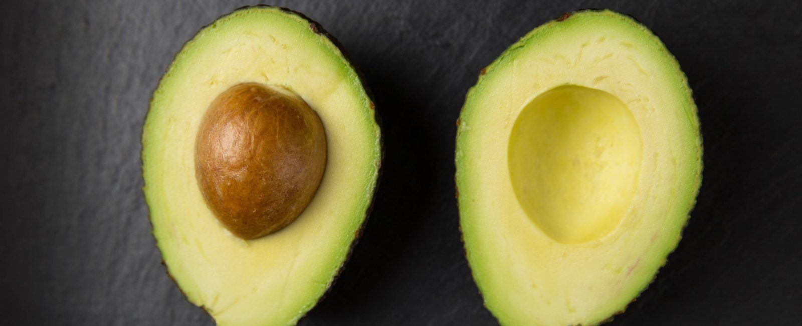 Avocado: All the health benefits you can reap from this nutritious fruit