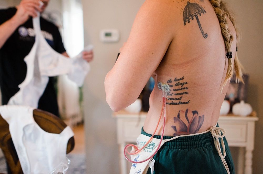 Young breast cancer - mastectomy recovery