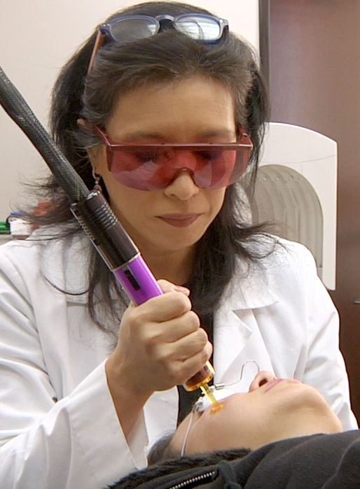 melasma laser treatment