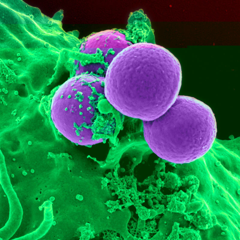 Mycoplasma Infection: What causes it and symptoms to look out for