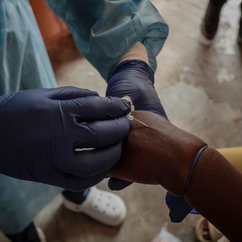 Everything you need to know about the mpox outbreak, and how Malaysia is preparing for it