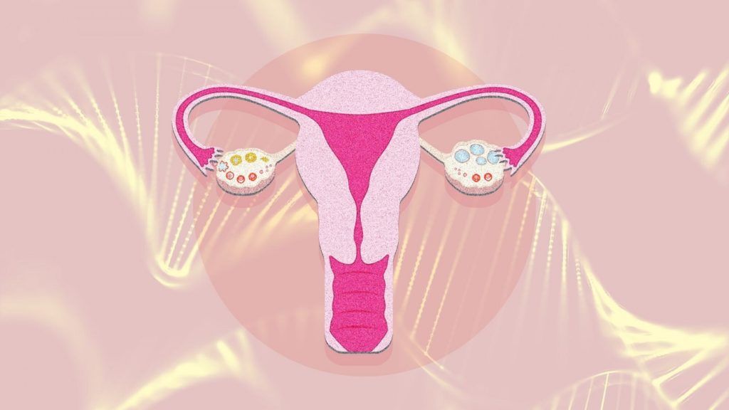 PCOS genetic? Here’s what we know so far, according to experts