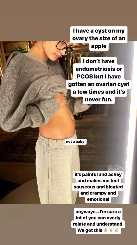 Hailey Bieber ovarian cyst